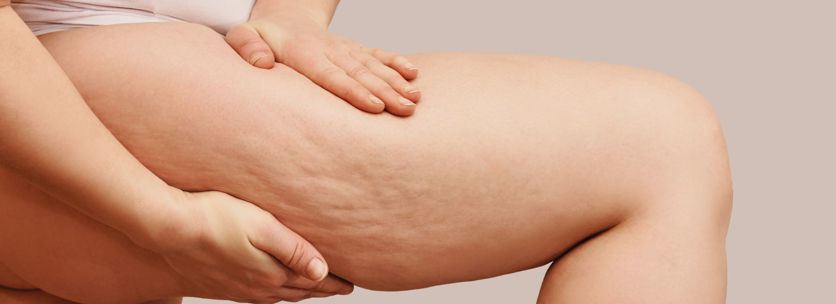 Unveiling The Cellulite Site: A Journey of Courage, Compassion, and Commitment