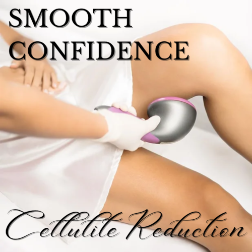 Achieve Smooth Confidence: Exploring SygmaBODY for Cellulite Reduction